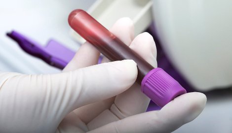 BMJLearning's tweet photo. Ask an expert: alcohol related liver disease - Consultant hepatologist Dr Stuart McPherson answers GPsโ questions on alcohol related liver disease (ARLD) https://t.co/FraR6ctg11 #alcoholawareness #gp #doctor #medtrainee #CPD #buildyourknowledge #bmjlearning @GlobalHealthBMJ https://t.co/jlGVvFYKkr