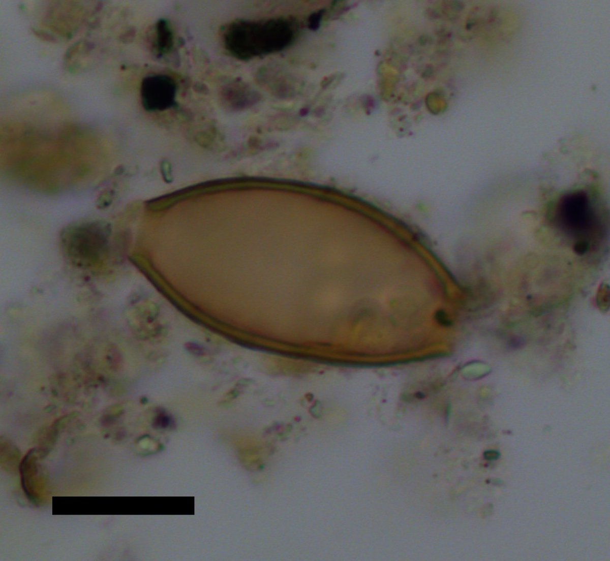 PUBLISHED: Ancient faeces reveal parasites described in earliest Greek medical texts associated with Hippocrates, the early physician and ‘father of Western medicine’ <a href="/sciencedirect/">Elsevier | ScienceDirect</a> <a href="/CamBioanth/">CambridgeBioAnth</a> goo.gl/QLW5nV