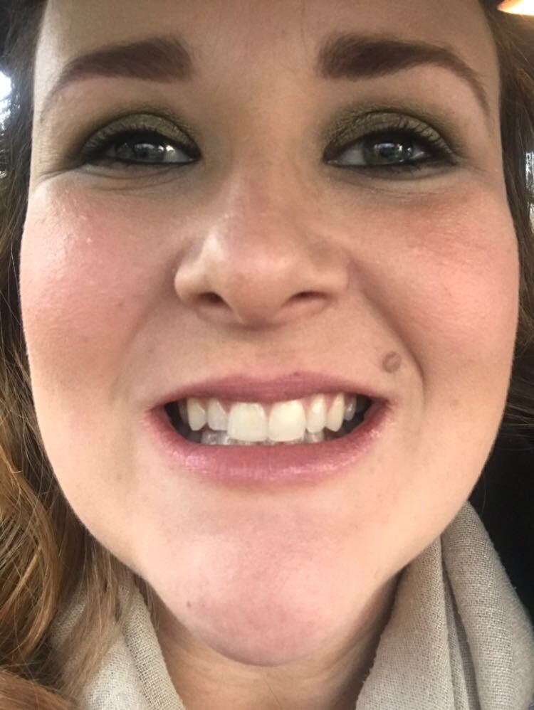 Shellys06704800's tweet photo. I'm so happy to say that my #ClearCorrect journey is complete and I have the smile I've always wanted! Thanks you Asmed you are amazing! #NewSmileCompany #LoveYourSmile #happy #AllIWantForChristmas #DentalDirectory https://t.co/d8UngSu5tx