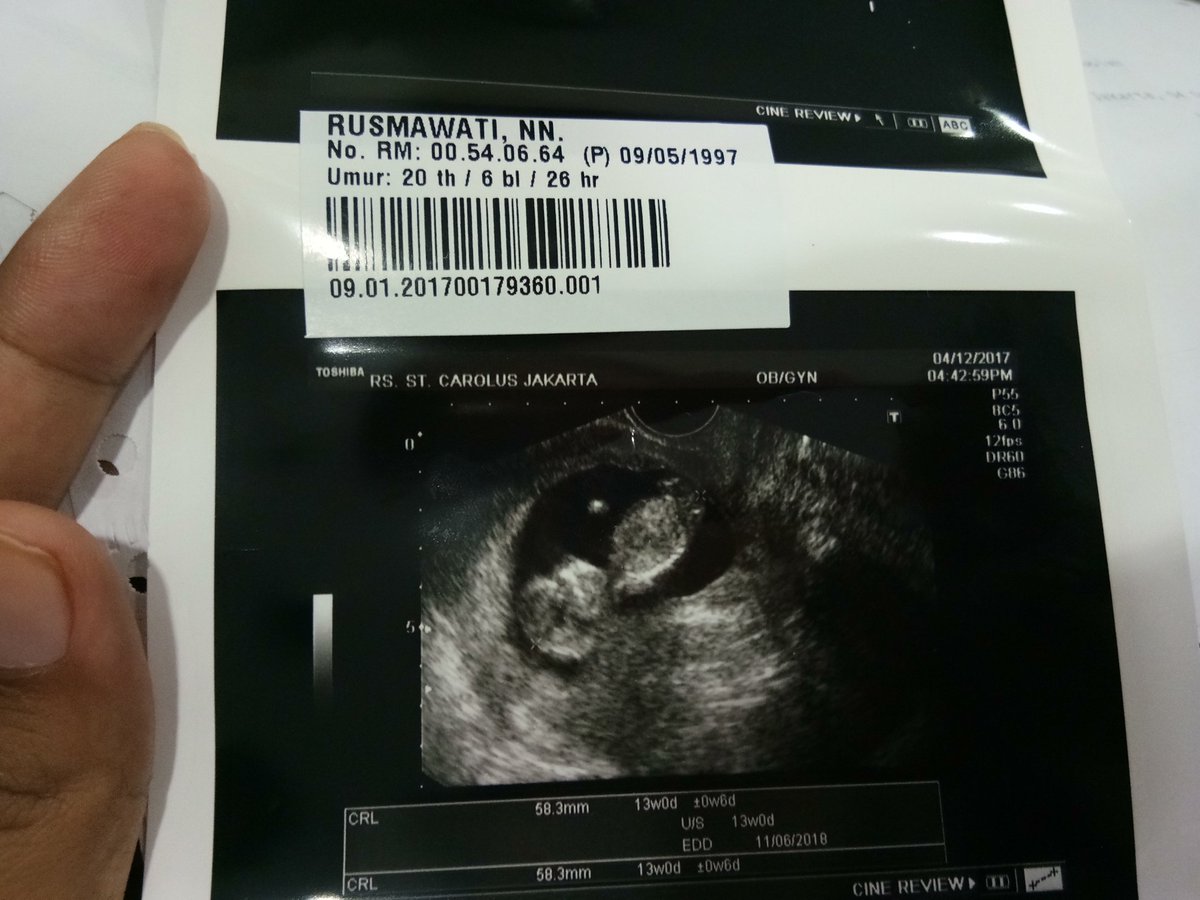 rusmaaa's tweet photo. 15 week ❤thanks Allah 😘👶 https://t.co/Ky0yCtfw4l