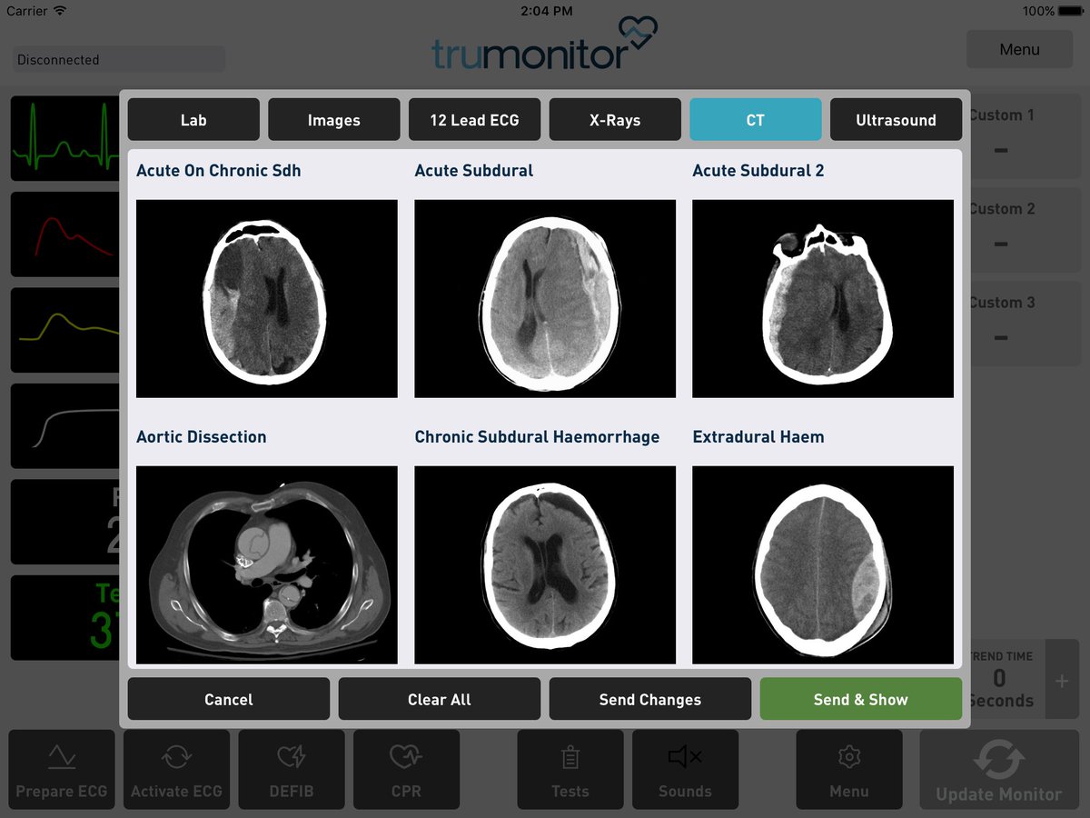 TruCorp_'s tweet photo. Do you want a FREE 21 day trial of our new #TruMonitor App?
Adjustable patient monitoring solution with adjustable parameters, 30+ ECGs, sound effects, Xray/CT images, create and store scenarios and much more!
•Easy to Set-up
•Easy to Access
•Easy to Use
E: info@trucorp.com https://t.co/4IGSwx9pEG
