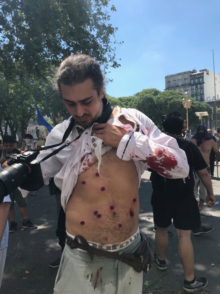 El Sindicato de Prensa de Buenos Aires denuncio la represión y el ataque a la libertad de expresión que padecieron durante la represión en el Congreso. Trabajadores de prensa heridos denunciaron cómo fueron brutalmente reprimidos <a href="/temasteleSUR/">Temas del Día</a> e