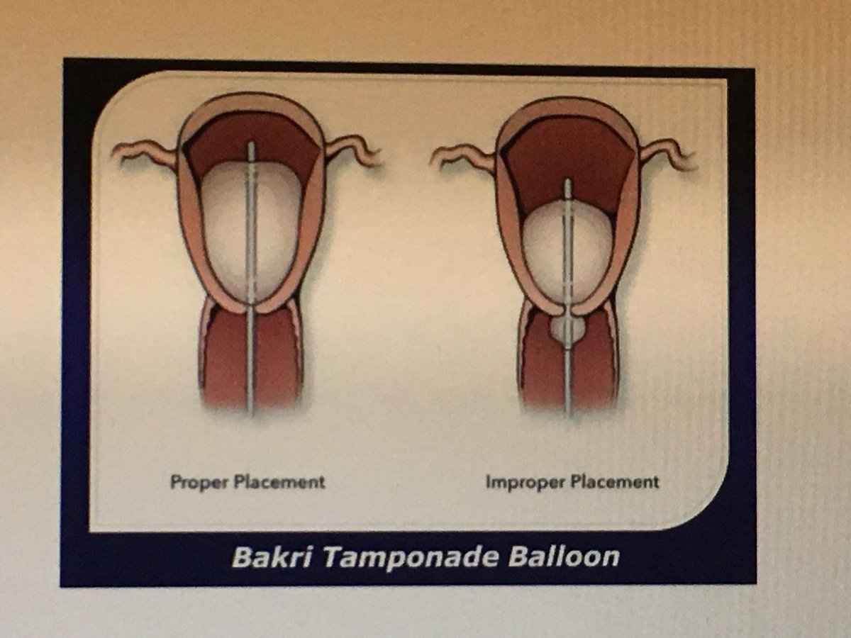 Yosh porno yaqin suratlar