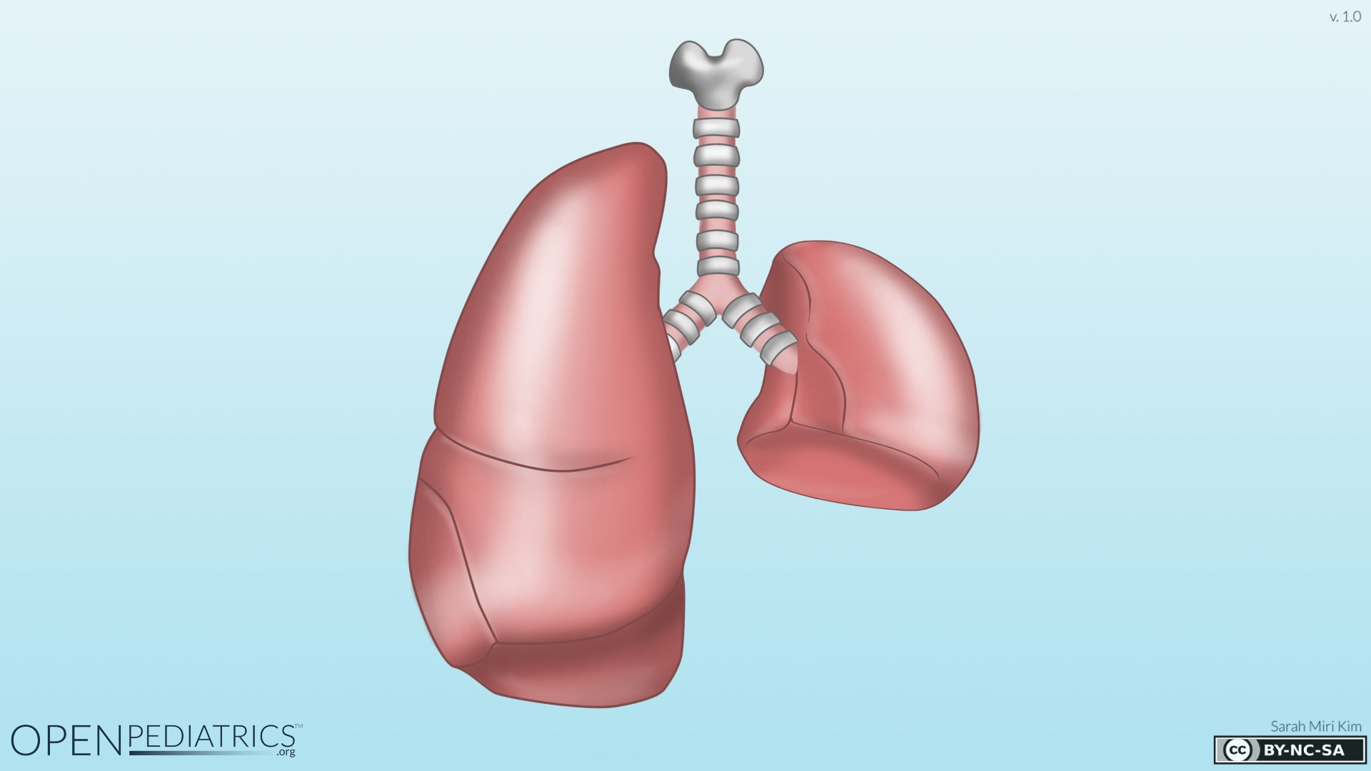 lung hypoplasia illustration