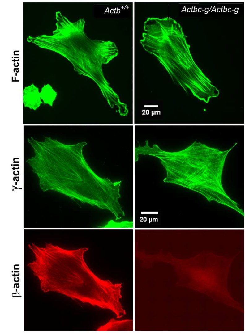 Christophe Leterrier So You Can Replace Ss Actin By A Second Gamma Actin Gene In A Mouse And It Doesn T Do Much Important Is To Have Two Differently Regulated Genes T Co F4yrcplmzh T Co U7dyt6as9g