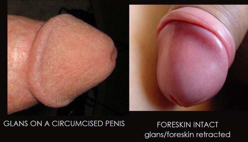 Without foreskin, the glans become dry and desensitized.pic.twitter.com/Haq...