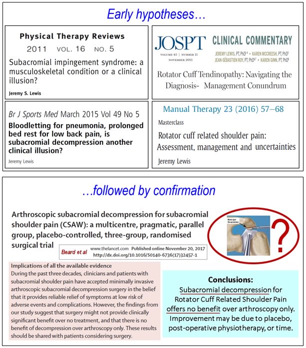 1st the hypotheses:

Clinical illusion:  tandfonline.com/doi/full/10.11…
Bloodletting: 
bjsm.bmj.com/content/49/5/2…
Management conundrum: jospt.org/doi/abs/10.251…
Rotator Cuff Related Shoulder Pain:
ncbi.nlm.nih.gov/pubmed/27083390

AND THEN the evidence:
thelancet.com/journals/lance…