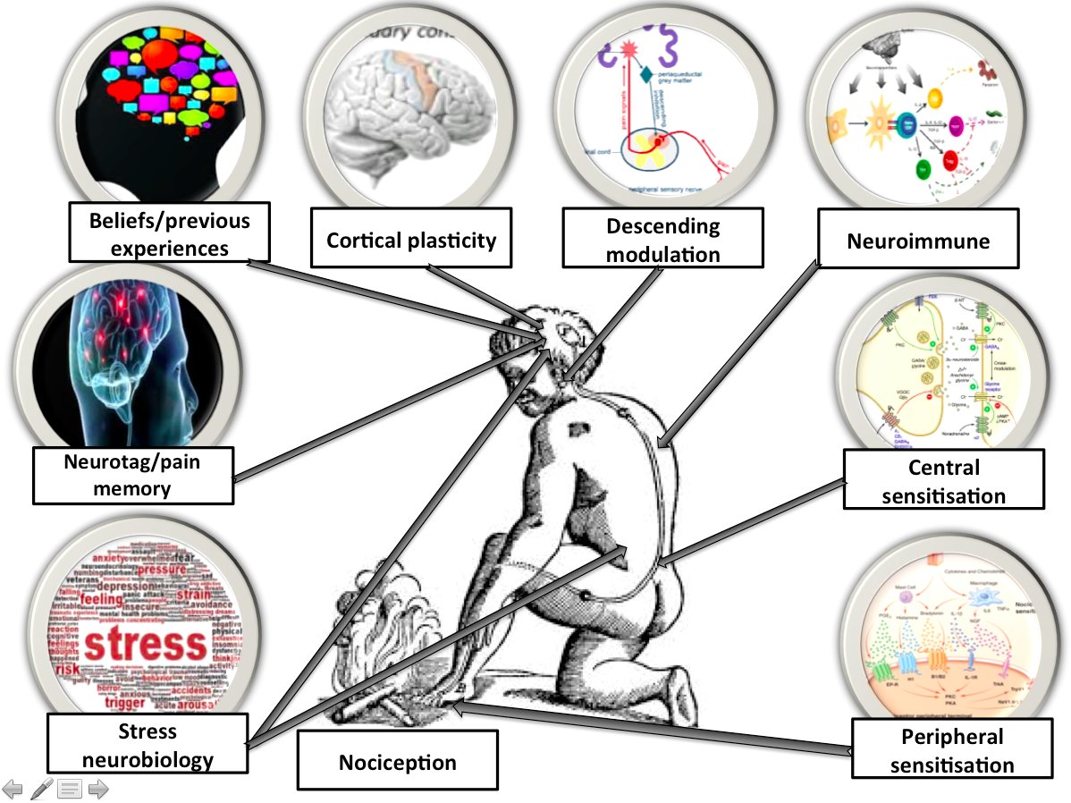 CorKinetic's tweet photo. This pain thing is quite complicated! https://t.co/YrDcardAsx