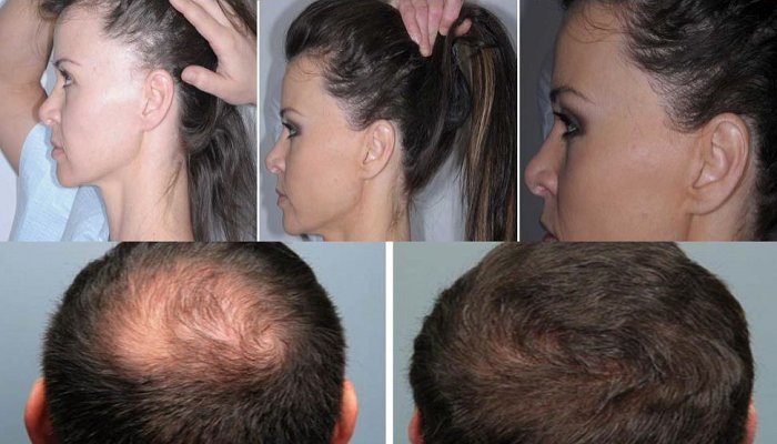 Follicle RX (@folliclerxoffic) / Twitter Follicle RX (@folliclerxoffic) / Twitter