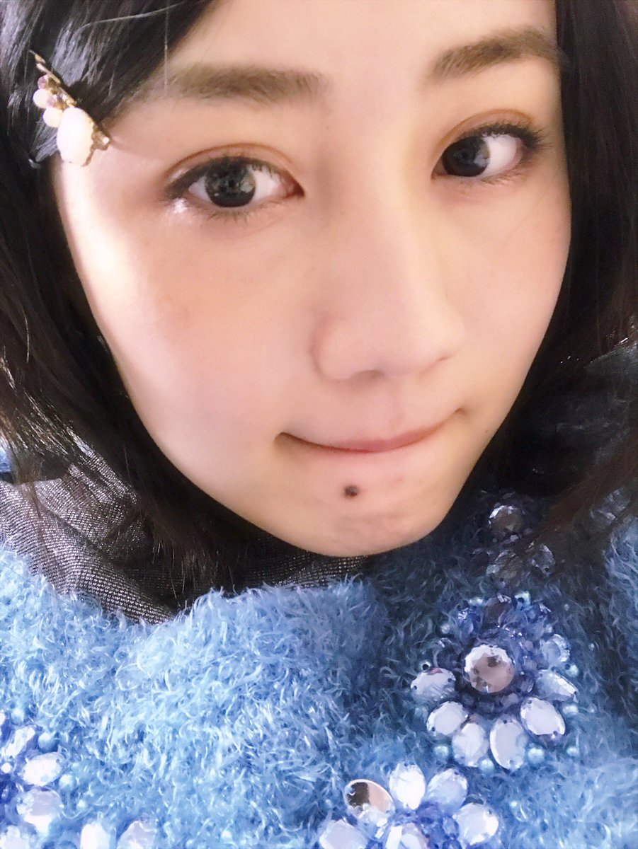 久代梨奈 ホクロ取れた 顔にはちゃんと残ってます