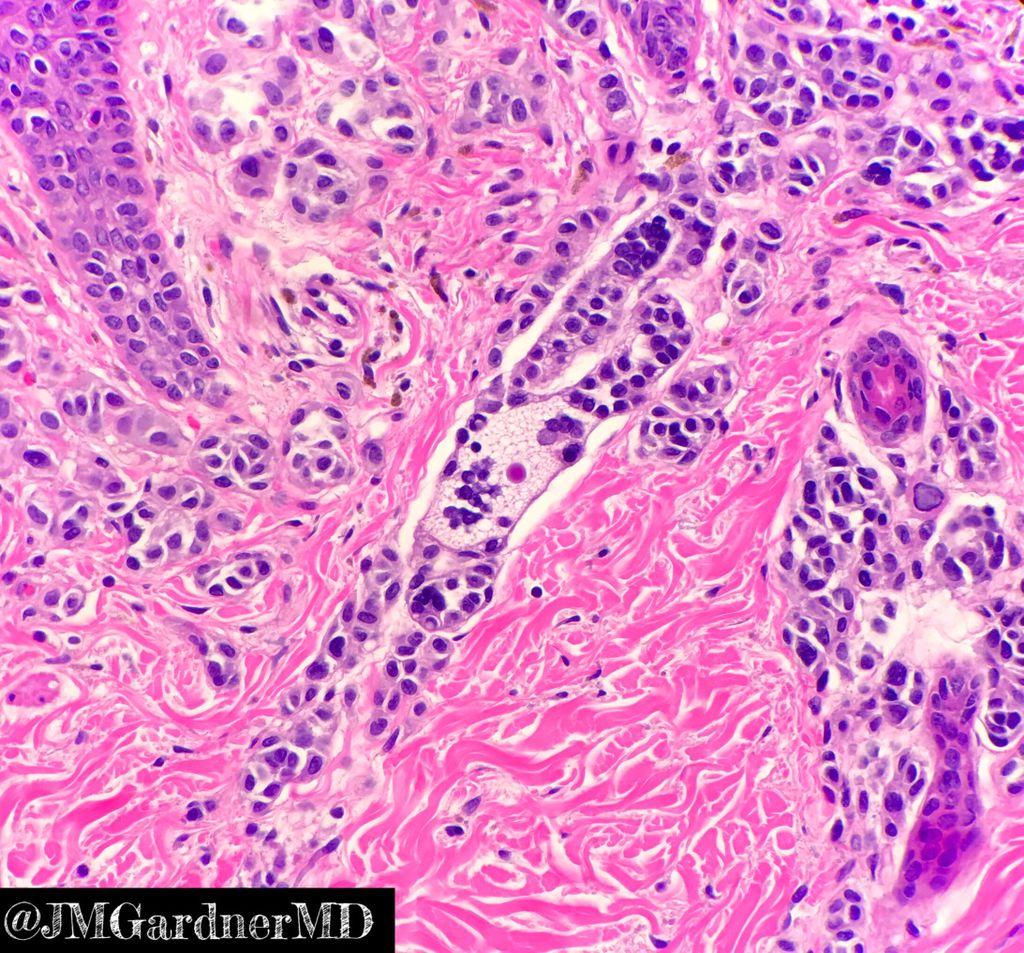 JMGardnerMD tweet picture