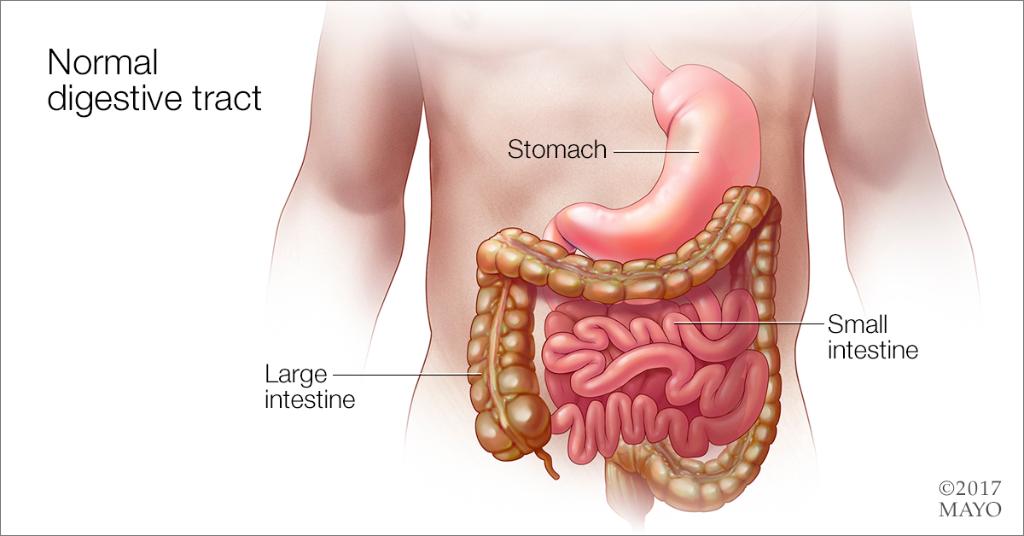 Gastroenteritis cetosis