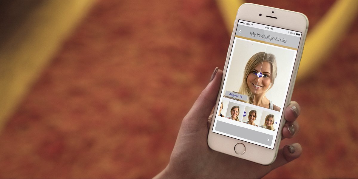 Wenn du ein Invisalign®-Patient bist, nutze die My Invisalign Smile-App, um deine Veränderungen nachzuverfolgen (und um sie zu feiern!).