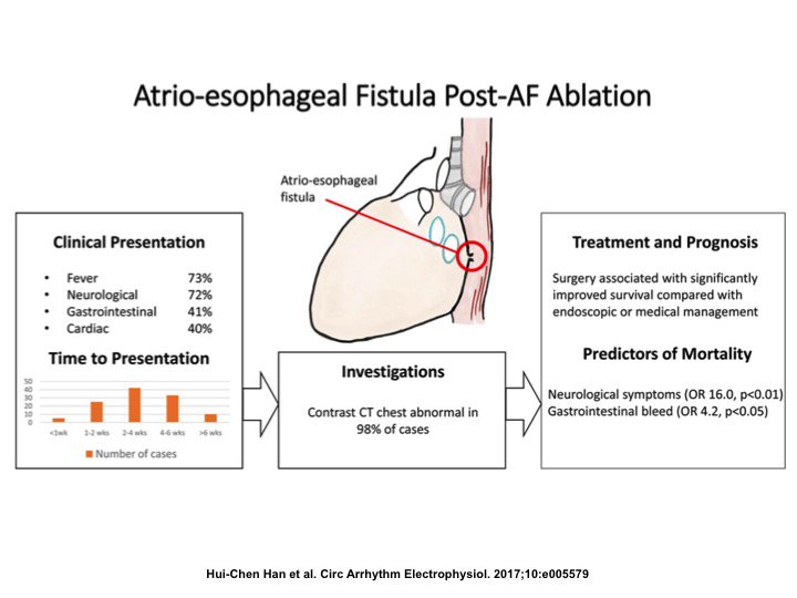 drraviele's tweet photo. Figure illustrating clinical presentation, diagnosis and treatment of post-AF ablation atrio-esophageal fistula #CircAE https://t.co/vTxZUyL388