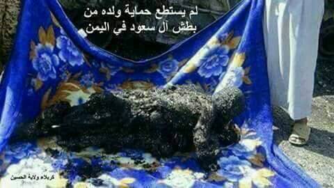 fuadntn's tweet photo. @shams_yemen شاهد الصوره الأب يحاول إنقاذ ابنه من القصف واحترقوا تفحموا جميعاً حسبناالله ونعم الوكيل https://t.co/tBRrgDBIHv