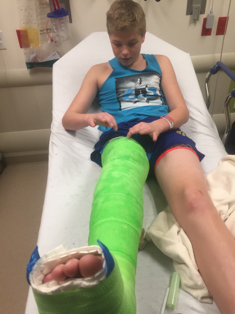 Snowboarding accident