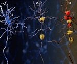 Journal_AJCPR's tweet photo. Researchers win NIH grants for Alzheimer's research on Amish resilience and rapid onset #Research #Alzheimers #NIH #PathologyNews #ClinicalPathology #PathologyResearch #SubmitManucripts #UpcomingIssue https://t.co/D7qARmPzDc