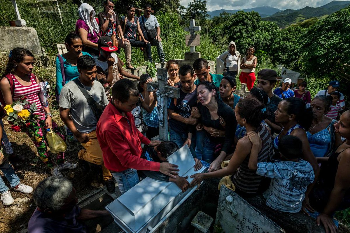 ElNacionalWeb's tweet photo. La malnutrición que mata en Venezuela https://t.co/MNyQLbAdX0  https://t.co/KuZNDklRjA