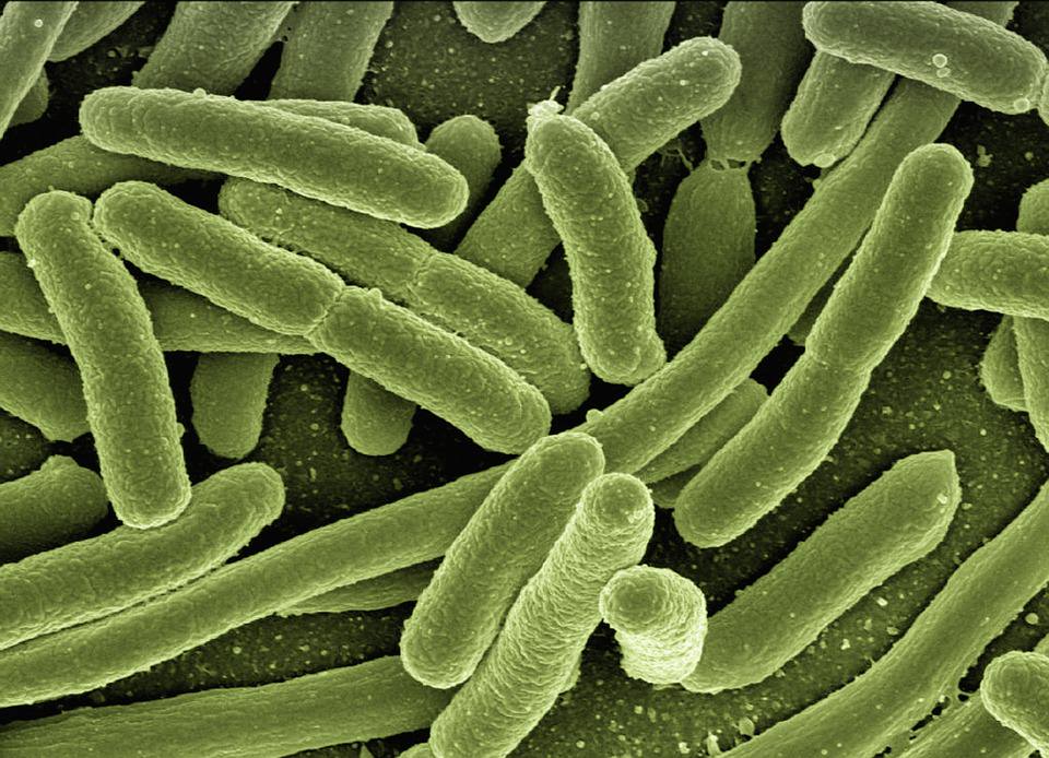 farmsnotfactory's tweet photo. "Diverse, abundant, and potentially mobile antibiotic resistant genes found in farm samples." Countless strands of disease causing bacteria are thriving due to the misuse of antibiotics in intensive animal farming. #health #medicine #organic Source: https://t.co/NOYRT2qBQD https://t.co/iakxLAQD0g