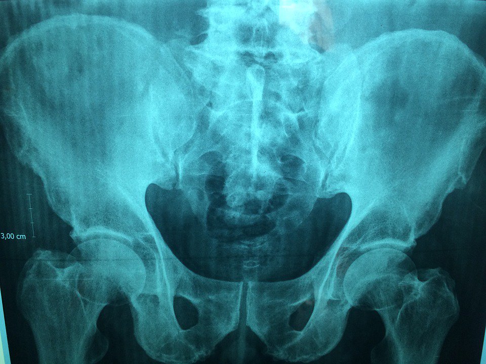WrldofAnalytics's tweet photo. "In #AI one of our priorities is the analysis of #medical #imaging material," says @sbxmip https://t.co/iBFGMTil4s #radiology #analytics https://t.co/jeEchwEWYx