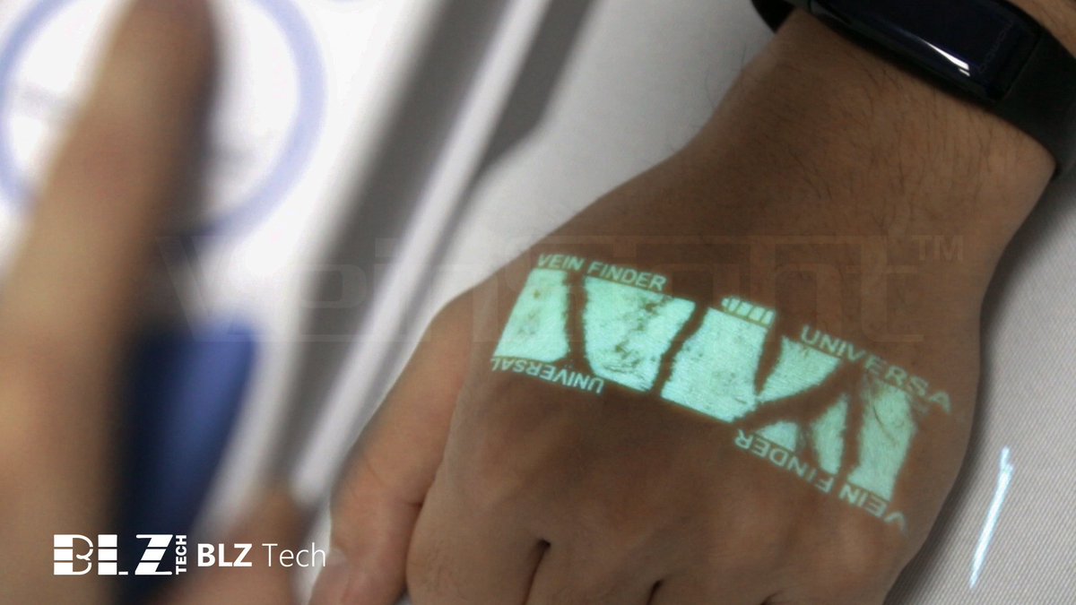 veinsight's tweet photo. VeinSighr Vein finder has three kinds of sizes for option, which can fit the need for different body part and different patient. 
website:https://t.co/gDR910EaWv
#veinfinder #medicaldevice #Medical #medicalequipment #medtech #technology #medtech2017 https://t.co/8bZfWsgkyp
