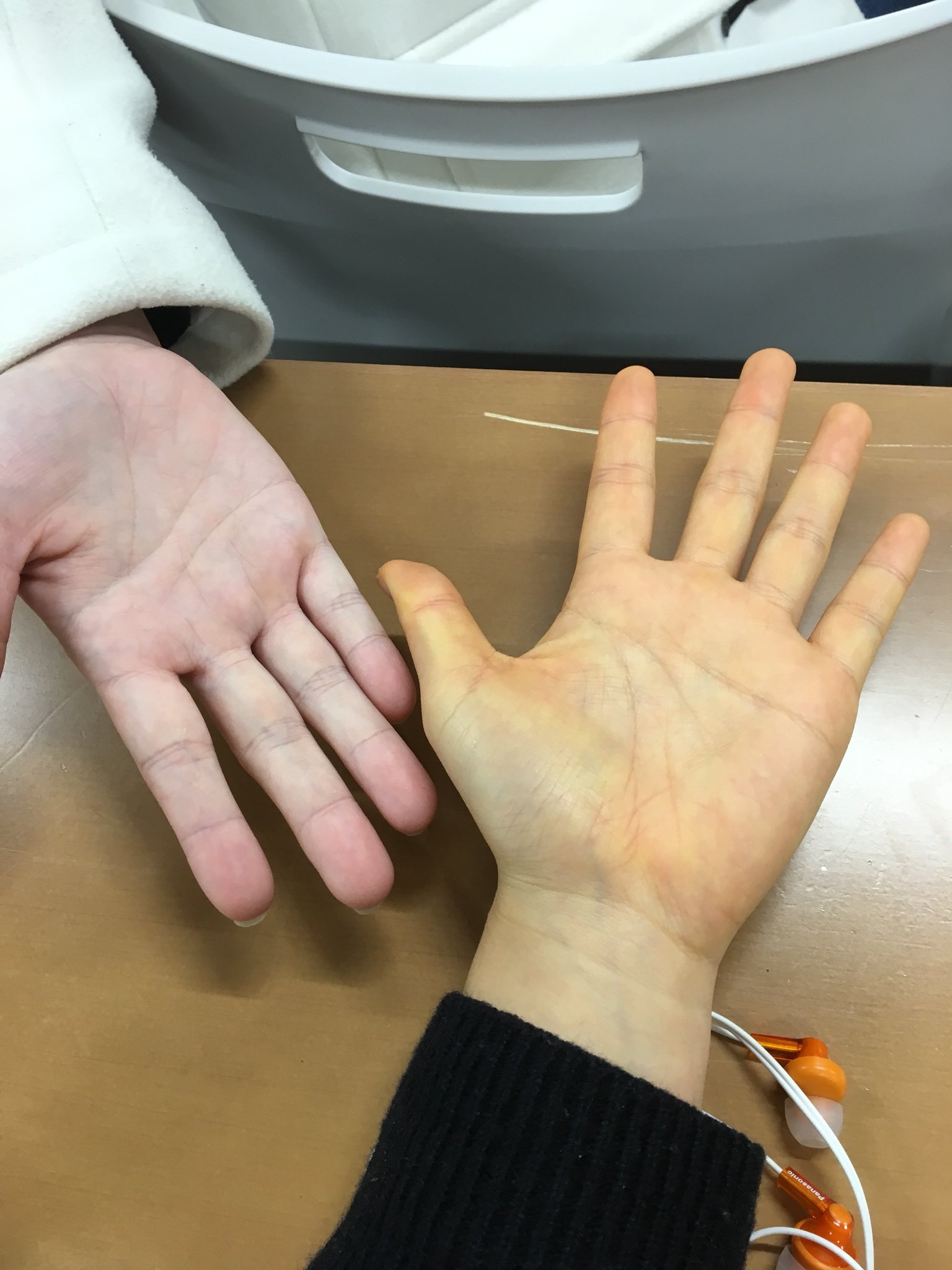 みかん 食べ 過ぎ 黄色