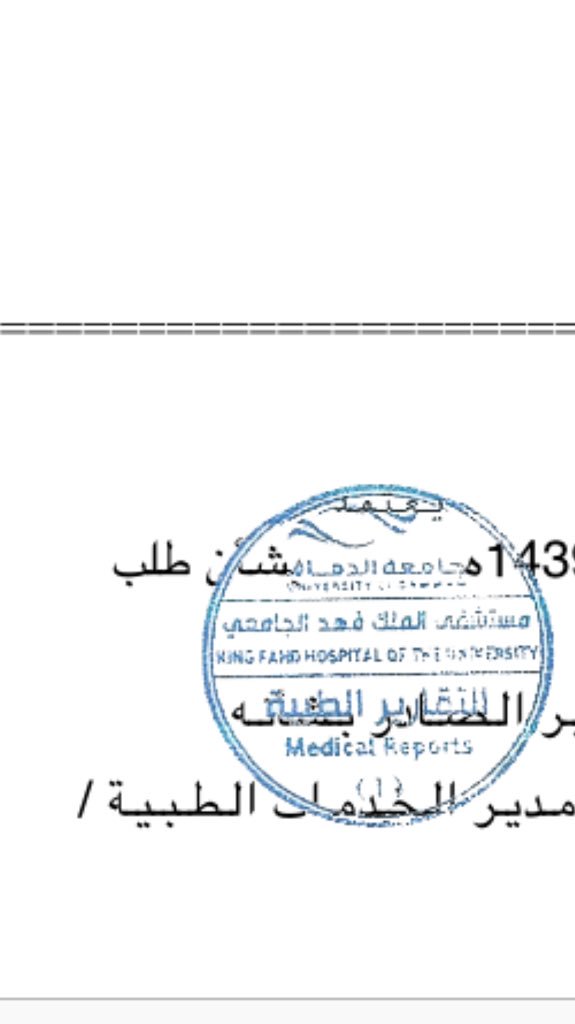 مستشفى الملك فهد للقوات المسلحة بجدة يكشف ملابسات تعرضه لحريق صحيفة صدى الالكترونية
