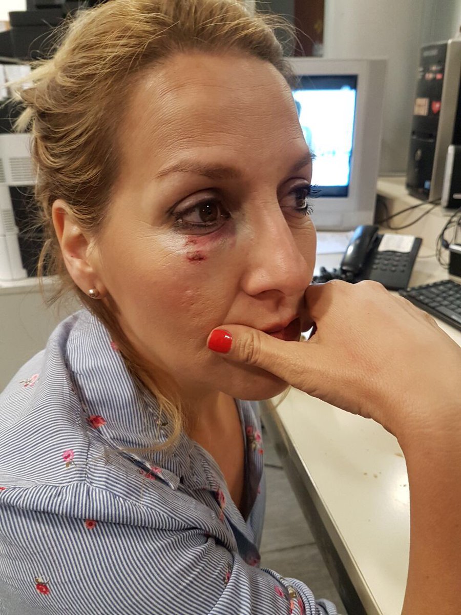 Se suma a la lista de periodistas heridos . 
Es Romina Mohr de noticiero <a href="/canal9oficial/">El Nueve</a> , toda mi solidaridad con ella y los demás cronistas golpeados