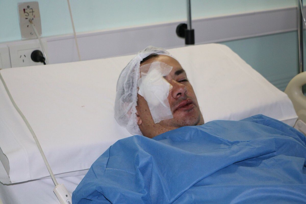gabrieliezzi's tweet photo. Policia con grave lesión en su ojo , a manos de los delicuentes organizados, hablemos de esto https://t.co/APOFNbEpRK