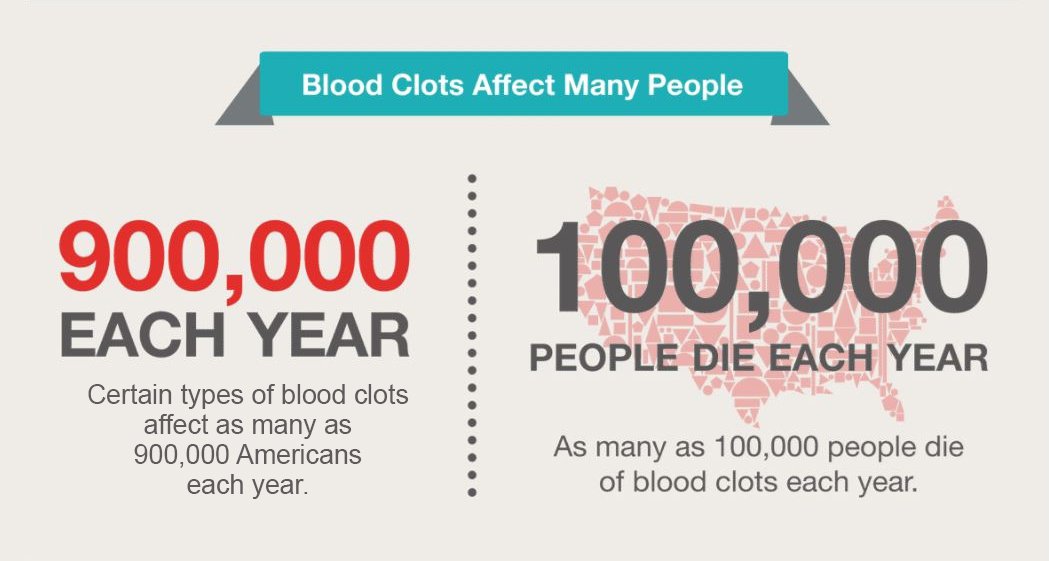 CDC_NCBDDD's tweet photo. Up to 100,000 Americans die from #bloodclots each year. #ItsAboutTime we learn the signs &amp; risks. Learn more: https://t.co/zRsNLoS6sY #ItsAboutTimeWeek https://t.co/CsgZg87vNa