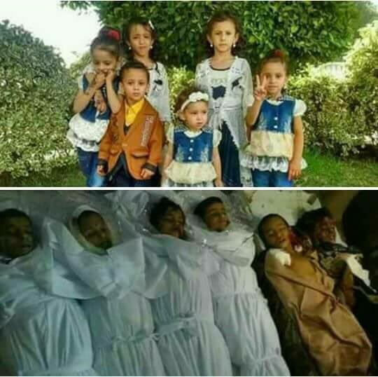 JawadAlbadry's tweet photo. #طفولة_اليمن_تعاني
#وملك_السعوديه يقتل الاطفال باليمن من اجل الشرعيه https://t.co/HFxmWfs2br