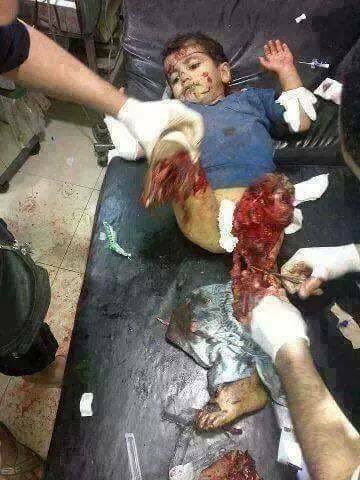 JawadAlbadry's tweet photo. #طفولة_اليمن_تعاني
#وملك_السعوديه يقتل الاطفال باليمن من اجل الشرعيه https://t.co/HFxmWfs2br