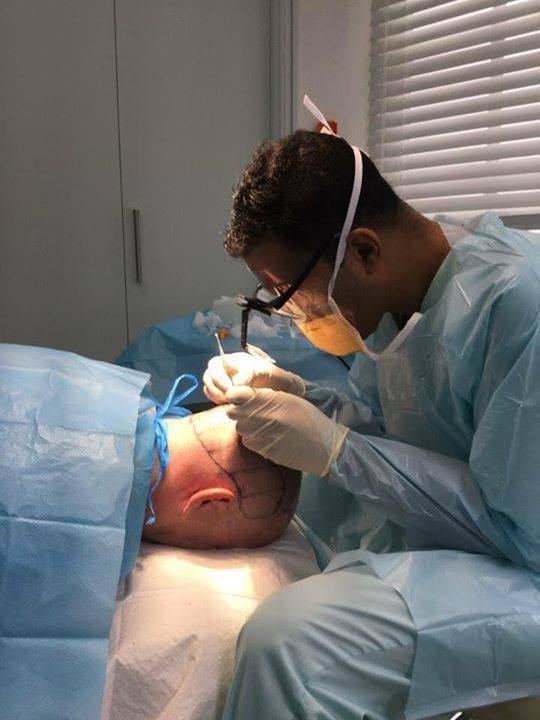 Behind the scenes - hair transplant at Harley Street.