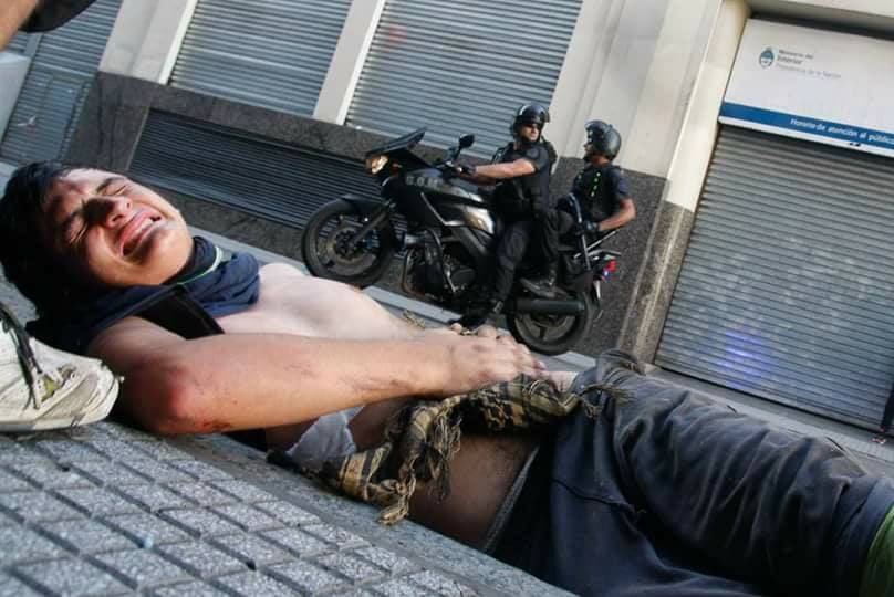 Solicitamos testigos de la agresión de las fuerzas de seguridad que recibió el compañero cartonero Alejandro Pipi Rosado de 19 años, atropellado por una moto de la policía ayer en Hipólito Yrigoyen entre Bernardo de Irigoyen y Tacuarí cerca de las 17hs.
Gabriela 11 6499-1384