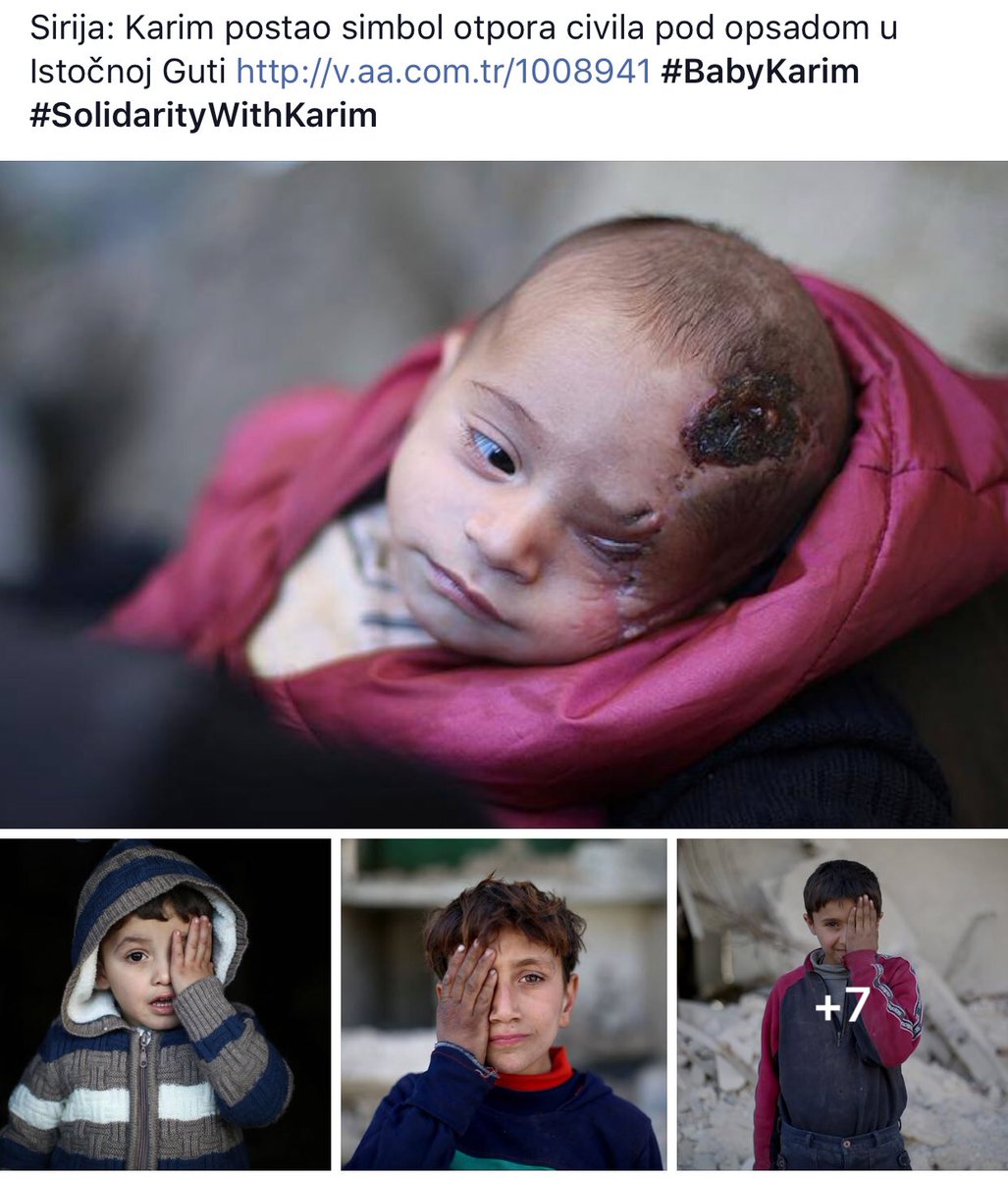 IIshakovic's tweet photo. #AssadWarCrime #AssadWarCriminal #ShameOnYouWorld #BabyKarim #SolidarityWithKarim #SyriaGenocide #ChildrenGenocide #GhoutaGenocide @antonioguterres @UN_News_Centre @UN_PGA @RT_Erdogan @MevlutCavusoglu @PutinRF_Eng @realDonaldTrump @CNN @BBCWorld @AJBalkans @SkyNews @FoxNews https://t.co/eXCw3IlUTz