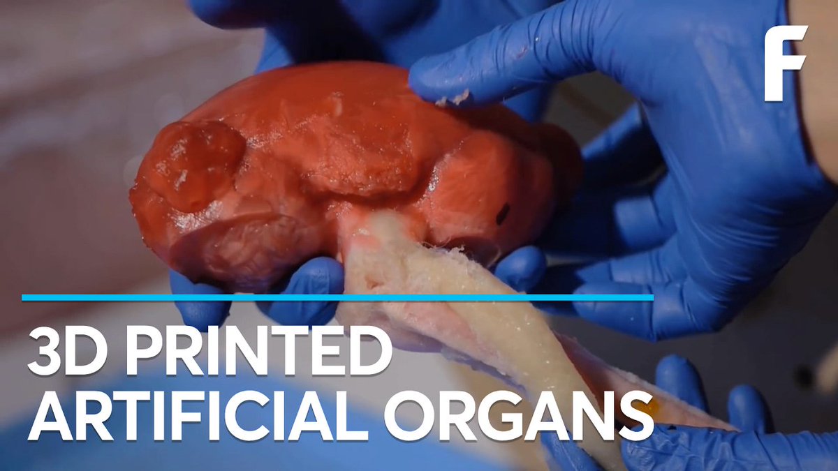enya_leckey's tweet photo. In the healthcare industry, doctors have found a way to 3D print a scaffold of human body parts and even organs with the patients living cells! For the organs, the scaffold is printed,coated in living cells and then incubated to create a working organ!(bleed like the real thing!) https://t.co/hwhtaqkrgy