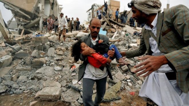 hussain_rehber's tweet photo. Today is the 1000th day of the #Saudi war on #Yemen.
#SaveYemen https://t.co/oukVUiWokm
