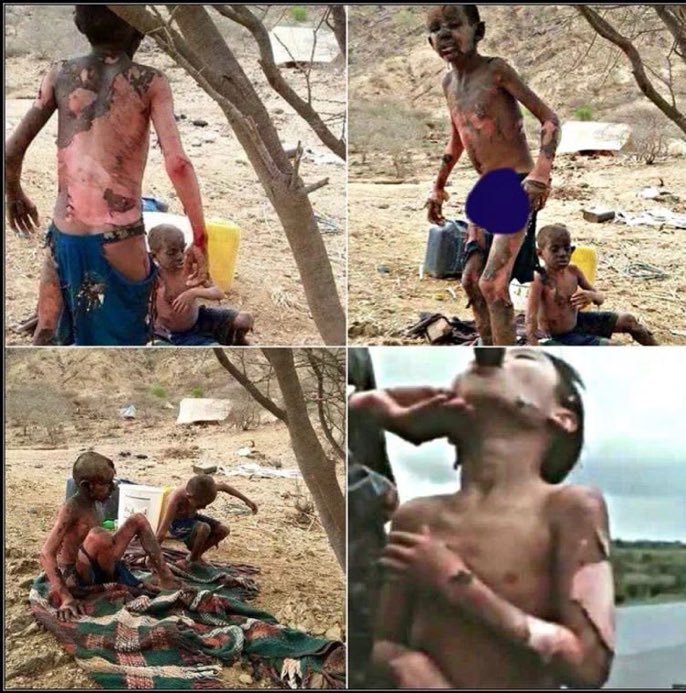 narkosun's tweet photo. “If those who support aggressive war had seen a fraction of what I’ve seen, if they’d watched children fry to death from Napalm and bleed to death from a cluster bomb, they might not utter the claptrap they do.” ~  @johnpilger #Yemen_Holocaust #AgainstAlSaud https://t.co/7zErQr7iKd