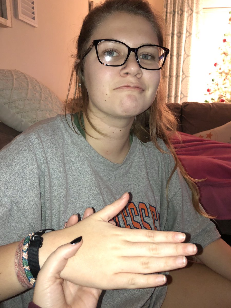 JeeeenaaD's tweet photo. @hannah_beets A year later and still concerned.... Hannah’s knuckles still haven’t grown in!!! #worried #mushyhands https://t.co/GVzjL58RdC