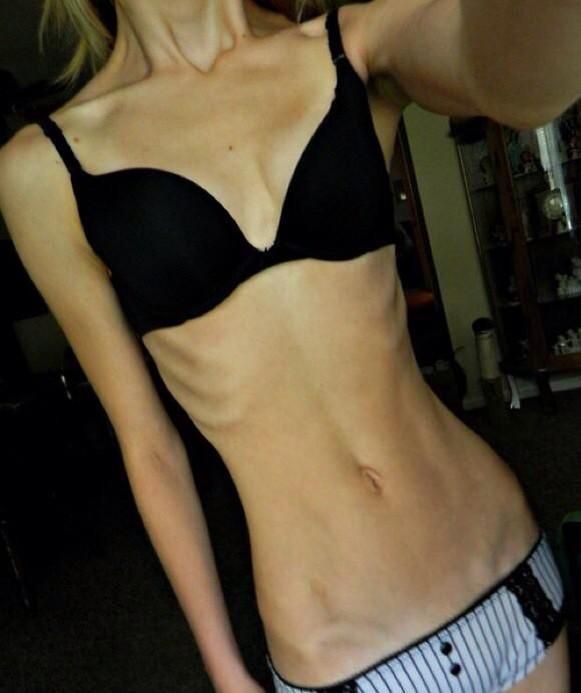 Beautiful #chestbones #abs #collarbones #ribcage #hipbones #panties #underw...