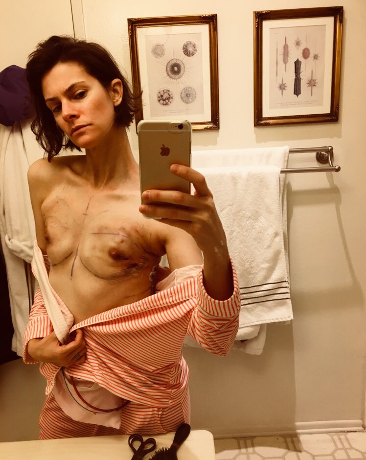devinsidell's tweet photo. #thisisme2017 #previvor #BRCApositive #brca1 https://t.co/YcZb5NUY8c