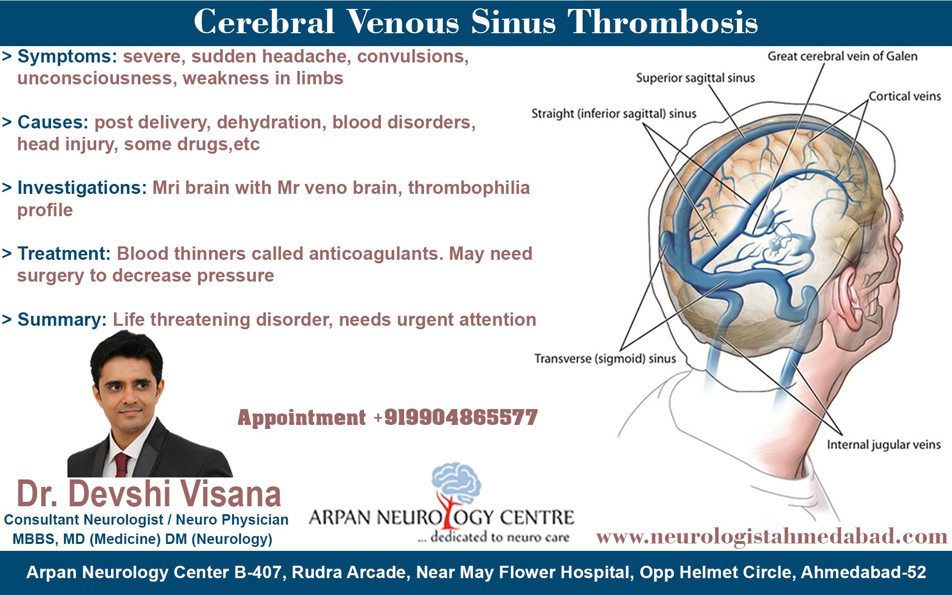cortical vein thrombosis