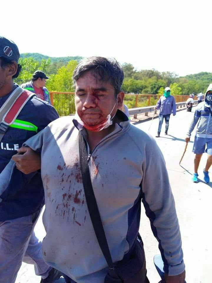 PatriaGrandeArg's tweet photo. #Ahora denunciamos y repudiamos la brutal represión de la que están siendo víctima los trabajadores del ingenio La Esperanza en #Jujuy !!
#BastaDeRepresion #bastadeperseguir 😡 https://t.co/MqJOGWVDPf