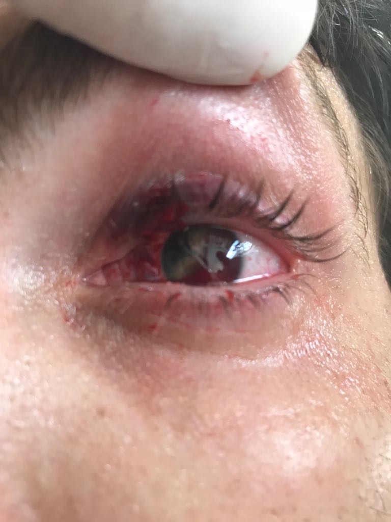 juan_amorin's tweet photo. El pibe se plantó a la Policía y les ofreció una flor en medio de la manifestación y le dispararon un balazo de goma en el ojo.

Ayer el presidente llamó héroes a los oficiales y delincuentes organizados a los que marcharon. https://t.co/tlit93up6W