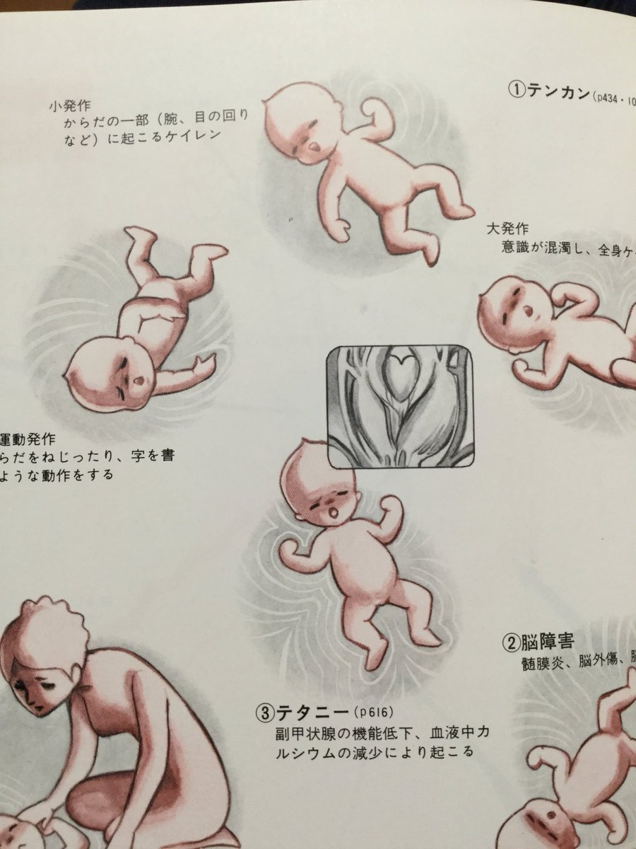 Kabuto 手塚治虫 やっぱり記憶が正しかった イラストは手塚治虫先生 調べたら1973年にブラックジャック 家庭の医学が1974初版 ぱっと見手塚タッチが確認できるのは何個かだなあ まったくわからないのもあるw