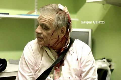 juliobazanok's tweet photo. Documento de la barbarie contra la prensa, que no podrá detener nuestra vocación de informar. https://t.co/4WVJlfUnQ5