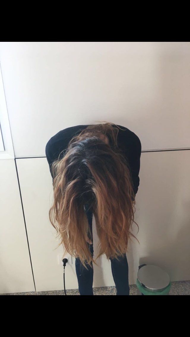 oncoalopex's tweet photo. Hoy es un día muy feliz!!Hemos conseguido ayudar a nuestra cliente y amiga Raquel a conservar su bonito y preciado pelo, después de 12 sesiones semanales de químio!! Gracias Raquel por tu simpatía, fuerza, coraje y alegría!! Oncoalopex!! Desmelénate!! #cáncer #caída #pelo #salud https://t.co/CDJsAs78DP