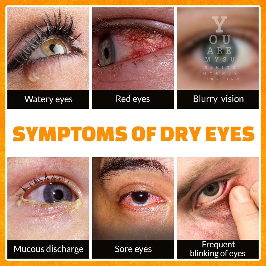 eventuslife's tweet photo. #Eventuslife advises you to take care of your eyes. We provide you access to the best ophthalmologists near you.
More Info:- https://t.co/oCf6C8C38r
Download the app today!
Android User: https://t.co/iIY6eRNpiD
iOS User: https://t.co/rFaKkLR1fw
#DryEyes #Eye #health #healthylife https://t.co/GfLgPEbzHK