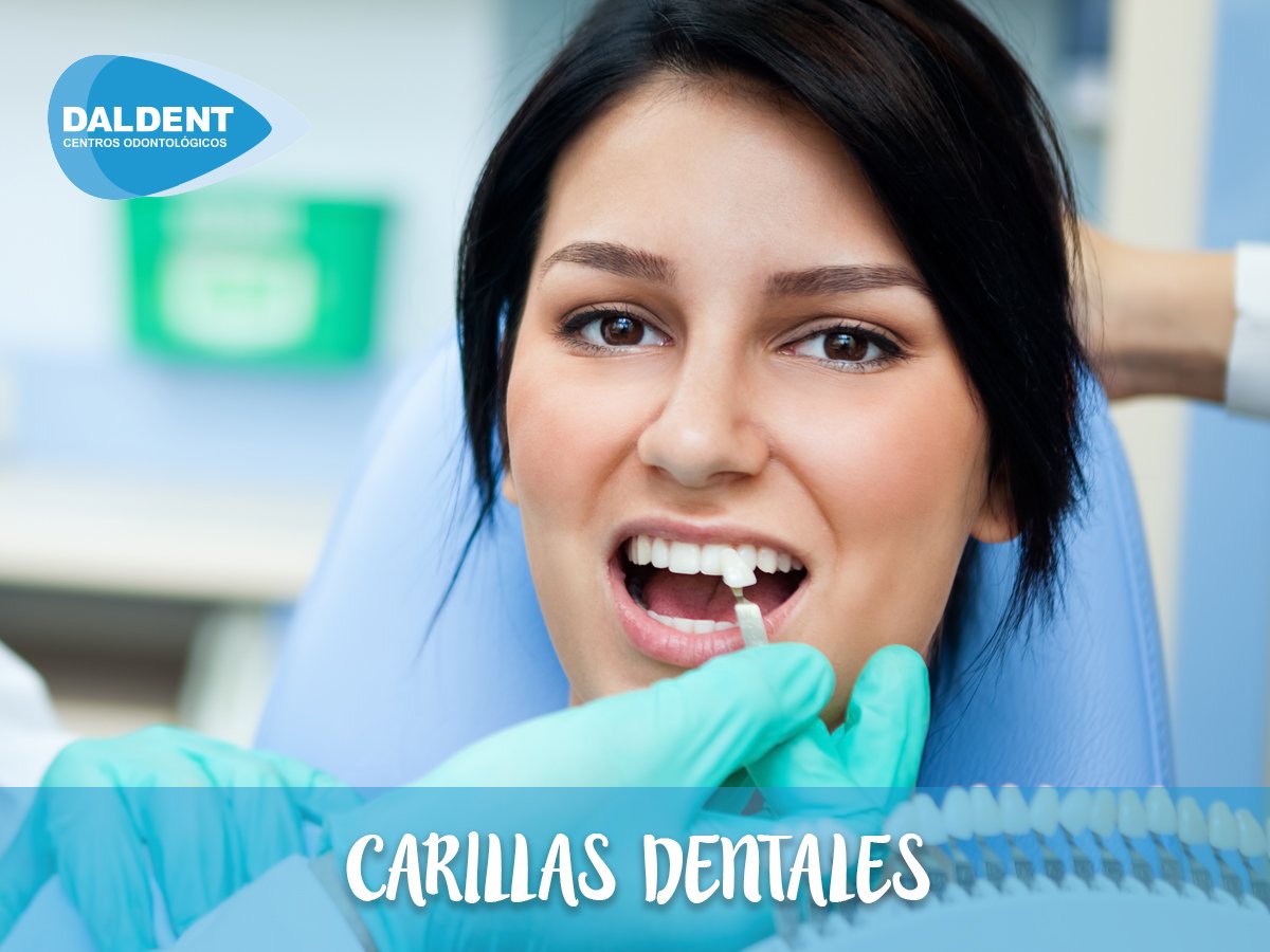 Las carillas dentales son unas finas láminas muy resistentes que se colocan sobre tus dientes para solucionar problemas estéticos. No dañan el esmalte y te proporcionan unos dientes más blancos, alineados y sin manchas en cuestión de minutos. 
#Dentista #Sanchinarro #LasTablas