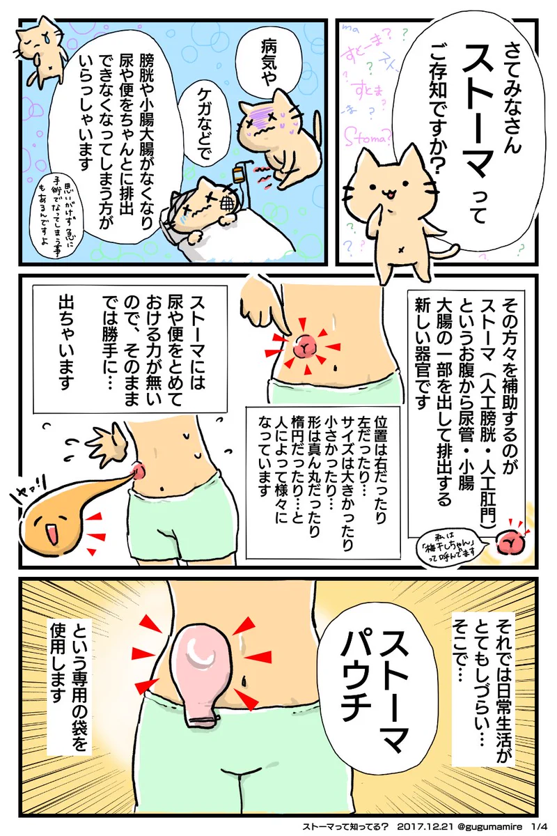 オストメイトトイレはなんのためにあるの？ストーマのことがよくわかる、可愛いイラストが優秀！！